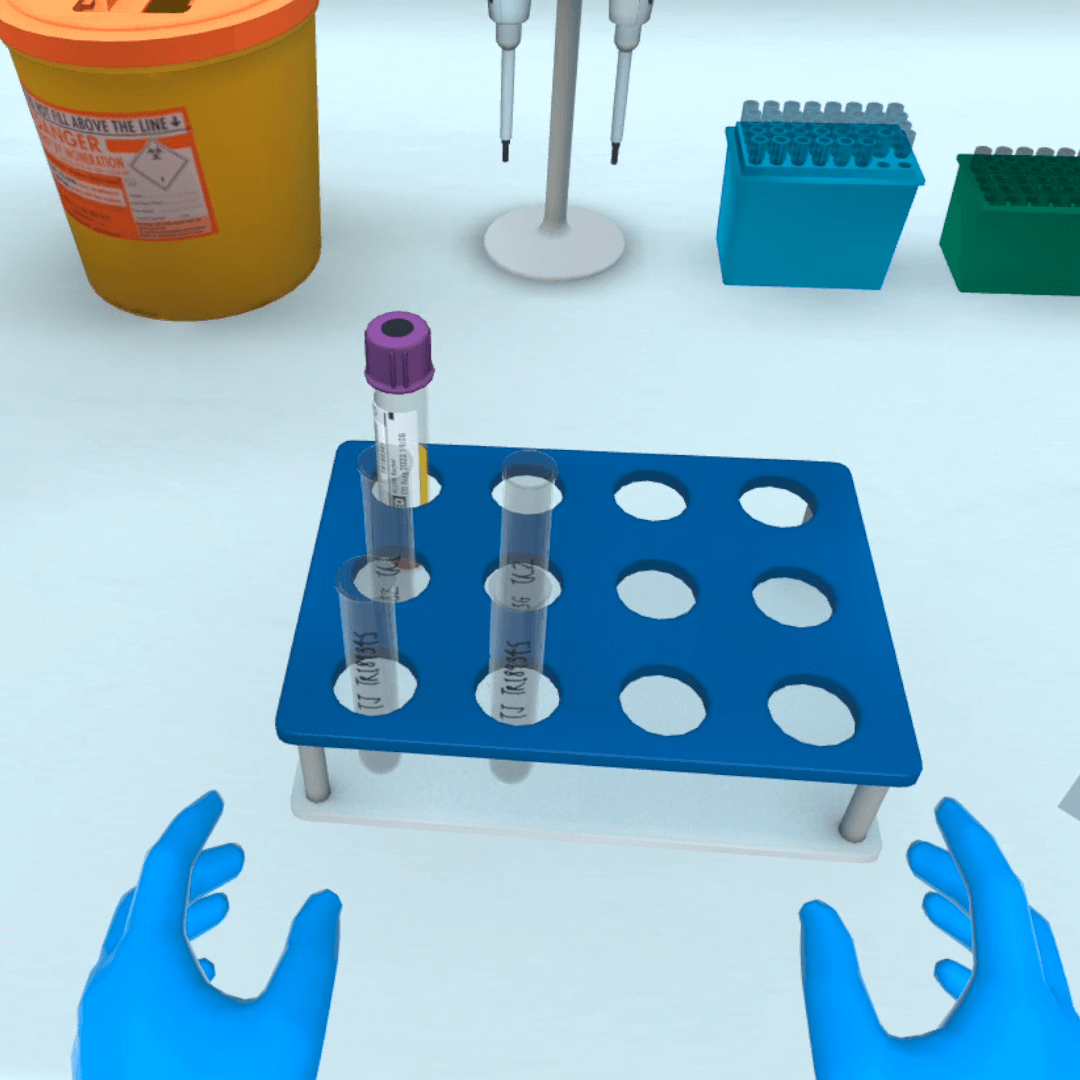 NHSBT – Crossmatching